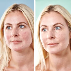 Sorted skin 5 in 1 Anti-Redness Day Cream SPF50 - 30 ml