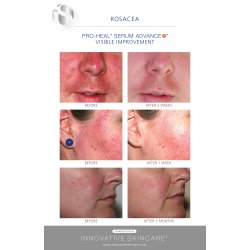 Is Clinical pro-heal serum advance+ 