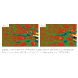 Profhilo Haenkenium Anti-oxydant Crme 50ml