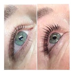 Sanzi vipperserum 5ml 