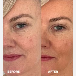 Vita Liberata The Serum - Anti Age Face Tan 15 ml.