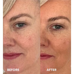 Vita Liberata The Serum - Anti Age Face Tan 15 ml.