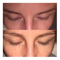 Sanzi vipperserum 5ml 