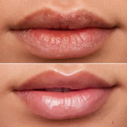 Wonderskin Lip Rehab Therapy Oil 3,57 ml - Clear