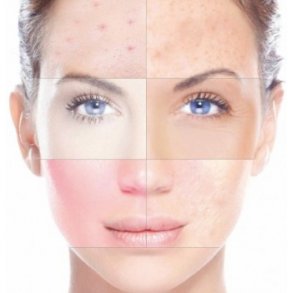 normal / kombineret hud