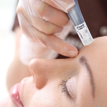 Micro Needle / Diamant slibning